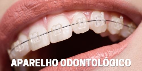 Aparelho Odontológico - Dentista Itapevi/SP - Centro