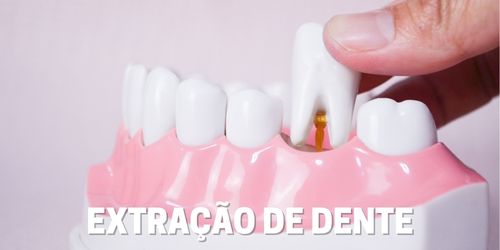 Extração de dente - Dentista Itapevi/SP - Centro