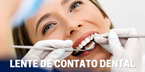 Lente de Contato Dental - Dentista Itapevi/SP - Centro